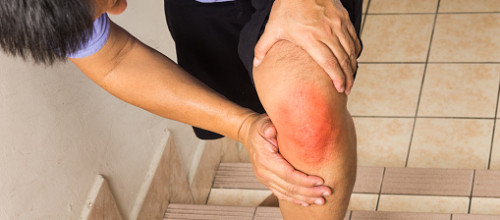Do you have pain while climbing stairs?