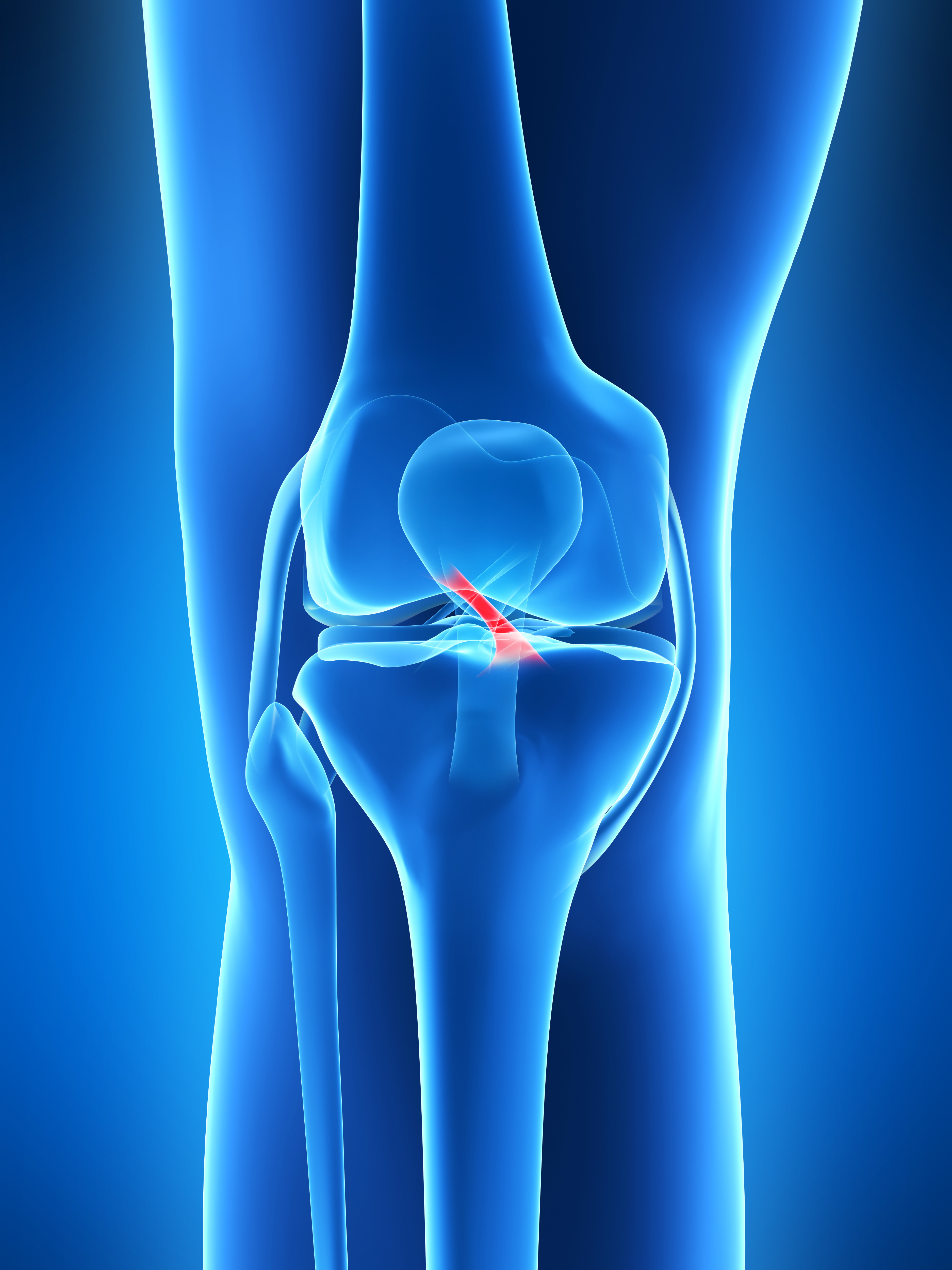 3 Reasons Why Females Are More Prone To Acl Injuries