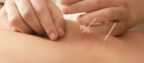Acupuncture Reduces Post-Operative Pain and Inflammation