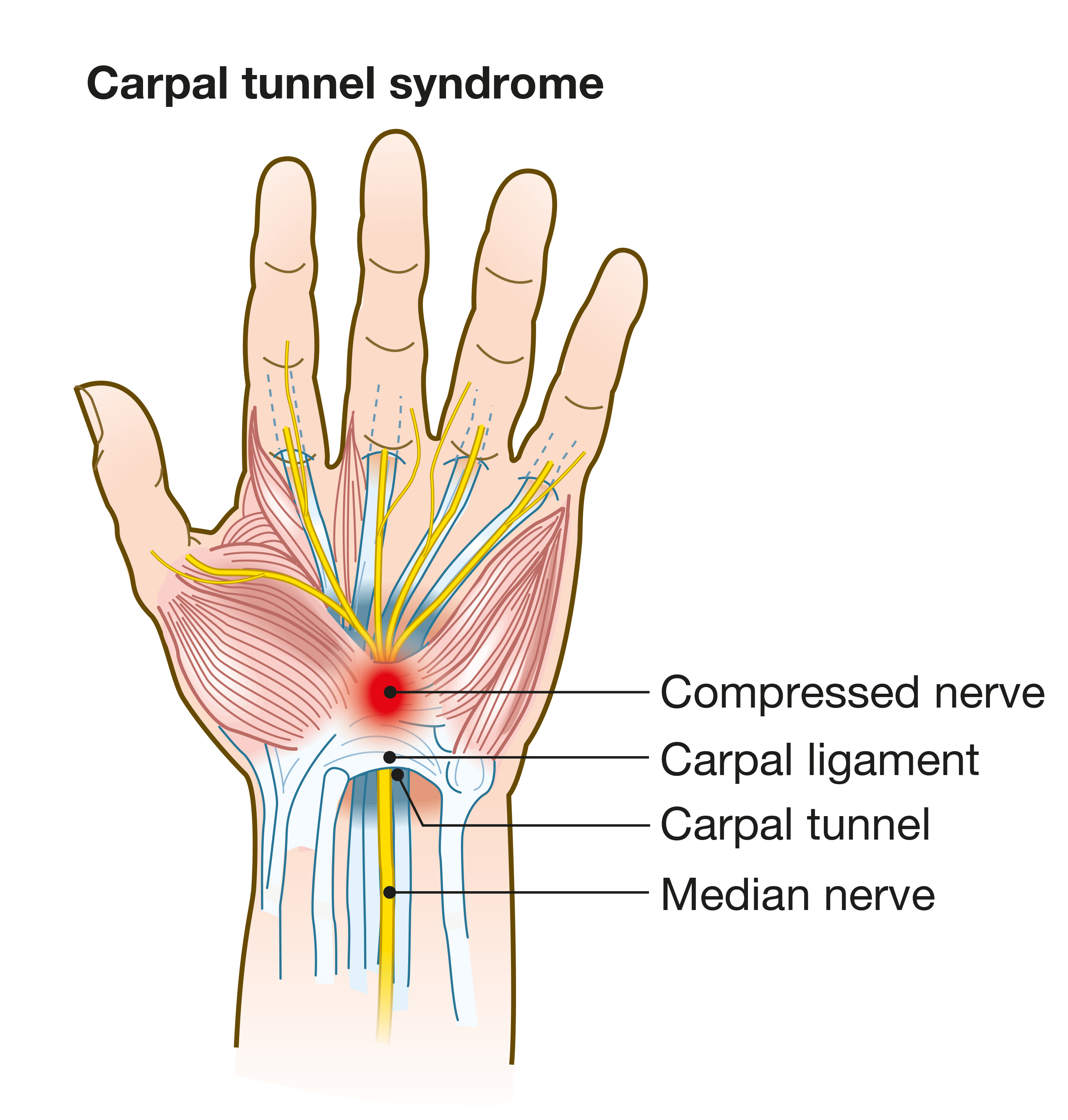 carpal tunnel contents