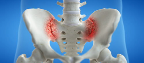 Is Your SI Joint Causing Your Low Back Pain?