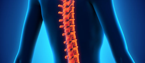 Do you have Spinal Stenosis???