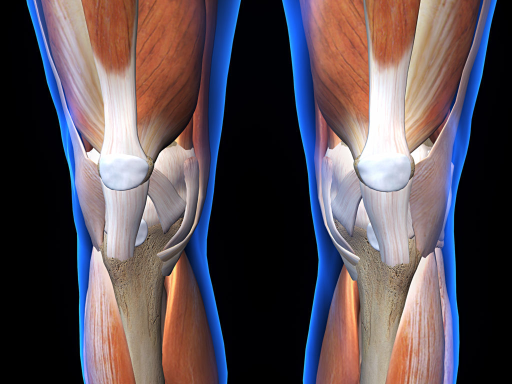Physical Solutions  Patellar Tendonitis - Physical Solutions